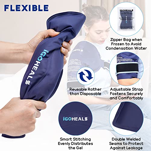 Igoheals Shoulder Ice Pack Wrap Rotator Cuff For Arm,Injuries Reusable Gel Heating Pack,Surgery Recovery,Pain Relief Hot Cold Therapy,Cold Compress Bag Left Right Shoulder Men Women-Soft Plush Lining #TOP3