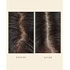 VEGAMOUR GRO Scalp Detoxifying Serum, Scalp Serum with Zinc PCA Removes Buildup & Soothes Scalp, Natural Citrus Scent, 2 fl. oz.