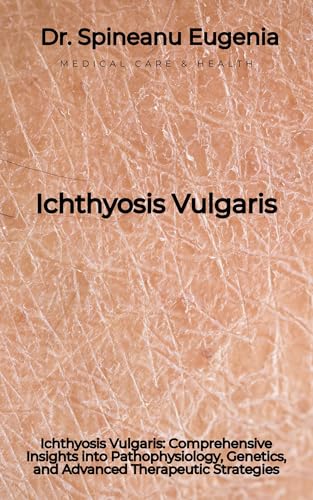 Ichthyosis Vulgaris: Comprehensive Insights into Pathophysiology, Genetics, and Advanced Therapeutic Strategies (English Edition)