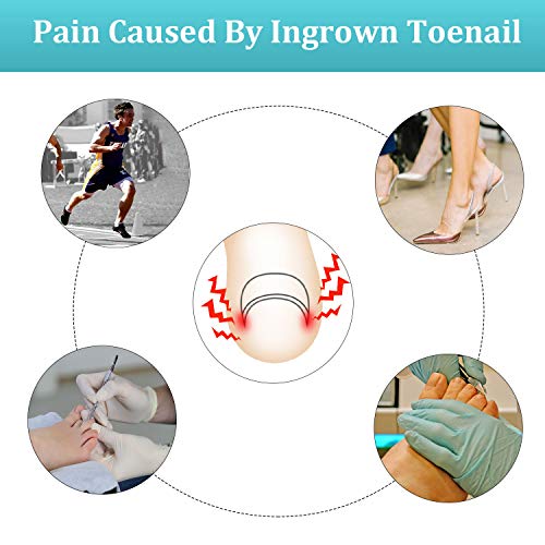 Mudder MUDDER-NAIL TOOLS-0673-M 122 Pieces Ingrown Toenail Tool Set, Include Ingrown Toenail File And Lifter, 60 Pieces Elastic Patch Curved Toenails Brace Stickers And 60 Pieces Ingrown Toenail Correction Stickers thumb #1
