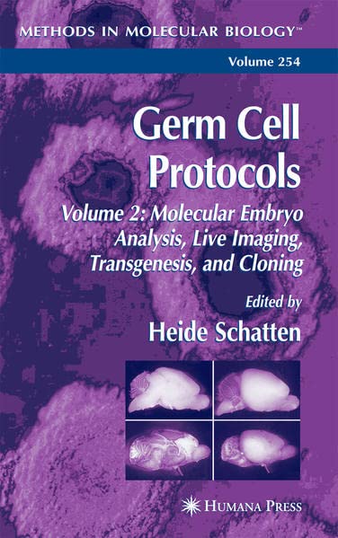 Buy Germ Cell Protocols: v.2: Molecular Embryo Analysis,Live Imaging,Transgenesis,and Cloning — BookShops.in