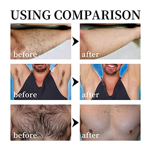 Woslxm Veze Hair Body Removal Cream, Veze Hair Removal Cream, Hair Removal Cream For Men, Hair Remover Effective & Painless & Soothing Depilatory Cream (2Pcs) #TOP6