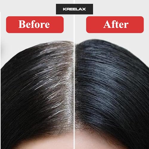 Image of Fruit Vinegar Hair Colour Black Ammonia Free | Gel Hair Color for Men and Women Instant Coloring in 10 Minutes Hair Black | Hair Dye with Natural Shine (500ml x 2)