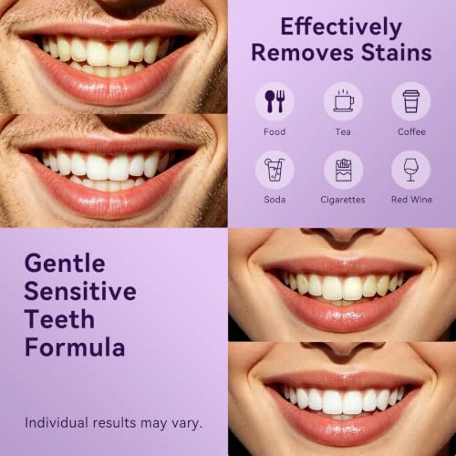 Purple Teeth Whitening Strips, Non-Slip Mint Strips, 28 Strips (Pack of 1) — view 6