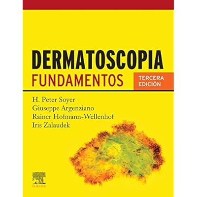 Dermatoscopia: Fundamentos