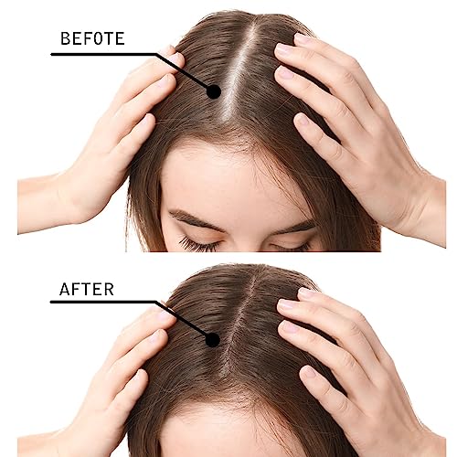 Hair Fibers for Thinning Hair for Women - Black - 27.5g Hair Building Fibers - Instantly Conceals Hair Loss - Revitalize Your Hair, Unlock Thicker, Fuller Tresses - Thumbnail 2