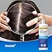 Ketoconazole Shampoo Kit for Scalp Treatment: 1% Ketoconazole Formula Dandruff Treatment - Itchy Scalp Relief, Seborrheic Dermatitis, Folliculitis Treatment, Psoriasis Shampoo - 8.4oz