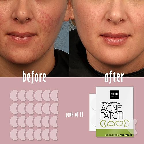 GREIGHT BRAND PRODUCTS Adesivos de espinhas para o rosto - (12 unidades) adesivos de acne hidrocolói