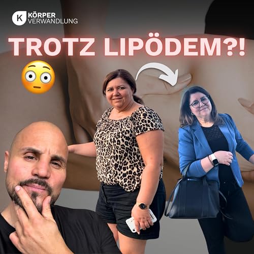 #272 Abnehmen trotz Lip&ouml;dem & Diabetes? Was dir wirklich niemand erkl&auml;rt