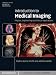 Introduction to Medical Imaging (Cambridge Texts in Biomedical Engineering)