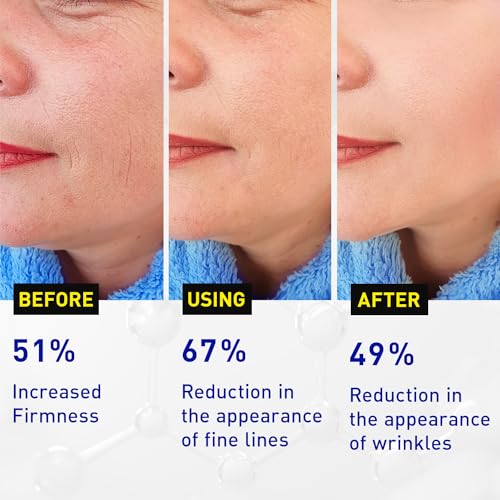 Vitamin C Face Serum for Anti Aging: Enaskin Naturals Super C Serum with Ferulic Acid for Women Mature Skin, Premium Formula Vit C Facial Serum for Brightening Dark Spots and Glowing up Skin - 1.7 Oz — view 3