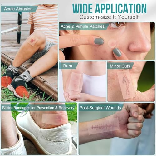 Image of Hydrocolloid Dressing Roll for Blisters, Burns & Acne, Waterproof Cut-to-Size Pimple Patch Roll, Medical Grade Wound Care Bandage for Heel Blister Protection & Skin Healing [ 5cm x 16 Feet ]