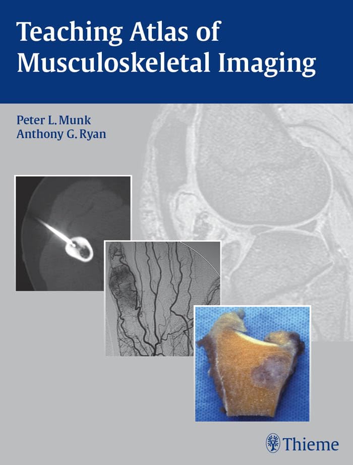 Teaching Atlas of Musculoskeletal Imaging (Teaching Atlas Series)