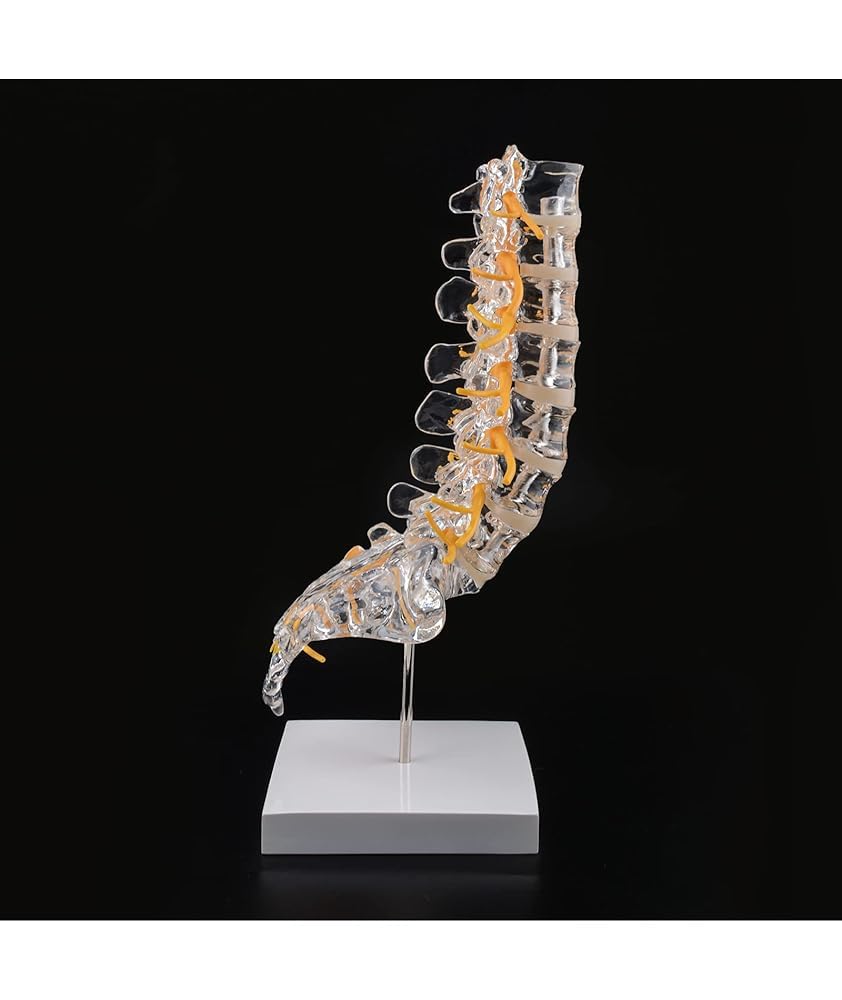 Ultrassist Human Transparent Lumbar Spine Anatomy Model - Model with Sacrum, Spinal Nerves and Intervertebral Disc Herniation, Life-Size Spine Model for Medical Education Teaching Demonstration