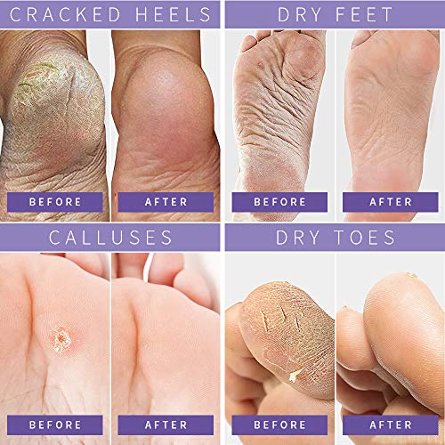 Foot Peel Mask 3 Pack, Dry Dead Skin Calluses Remover Exfoliating Repair Rough Cracked Heels for Baby Soft and Smooth… - Image 6