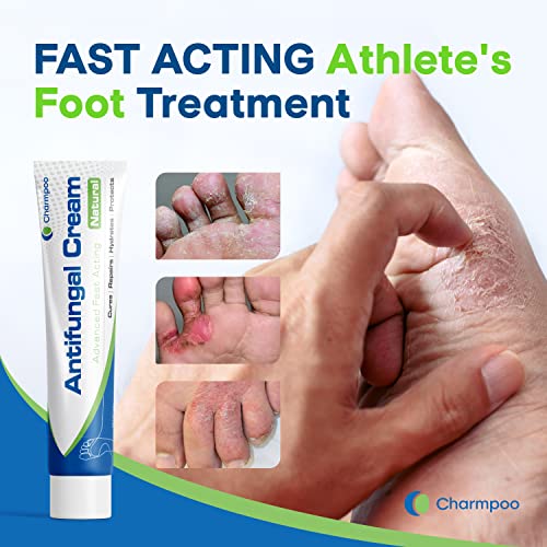 CHARMPOO Antifungal Cream Athletes Foot Antifungal
