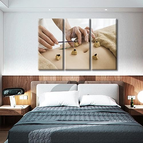 Image of TUMOVO 3 Panels Moxibustion Canvas Wall Art Moxa Moxibustion Posters Paintings for Wall Decorations Nosocomium Artwork Canvas Photo Stretched and Framed Ready to Hang (60 inch Wx40 H)