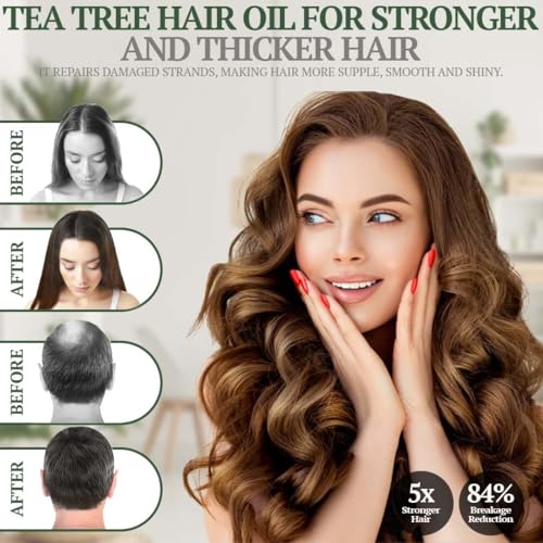 Image of Fiora Naturals Tea Tree Oil for Hair and Scalp - with Jojoba, Grape Seed & Castor Oils - Helps Hair Growth, Soothes Itchy Scalp & Fights Dandruff - Moisturizes and adds Shine - 4 fl oz