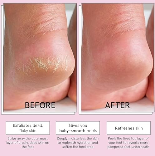 image for grace & stella Award-Winning Foot Peel Mask (4 Pairs, Lavender) - Foot
