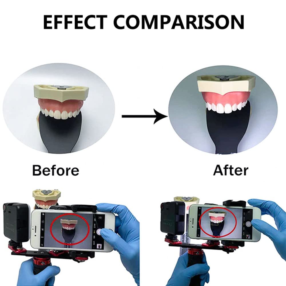 Kit de fotografía dental para odontología, linterna de teléfono móvil, luz de llenado oral, uso de dentistas, equipo de video fotográfico