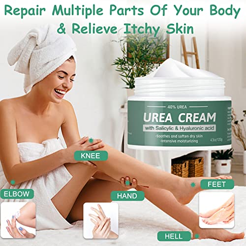 Mokyduo Urea Cream 40% For Feet, Foot Cream/Lotion, For Cracked Heels, Ultra, Rough, Dry, Calloused Feet, Softening Rough Skin On Feet, Foot Cream Skin Care With Glycerin, Jojoba For Men/Women, 4.3 Oz #TOP2