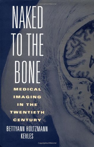Naked to the Bone: Medical Imaging in the Twentieth Century (Sloan Technology Series)