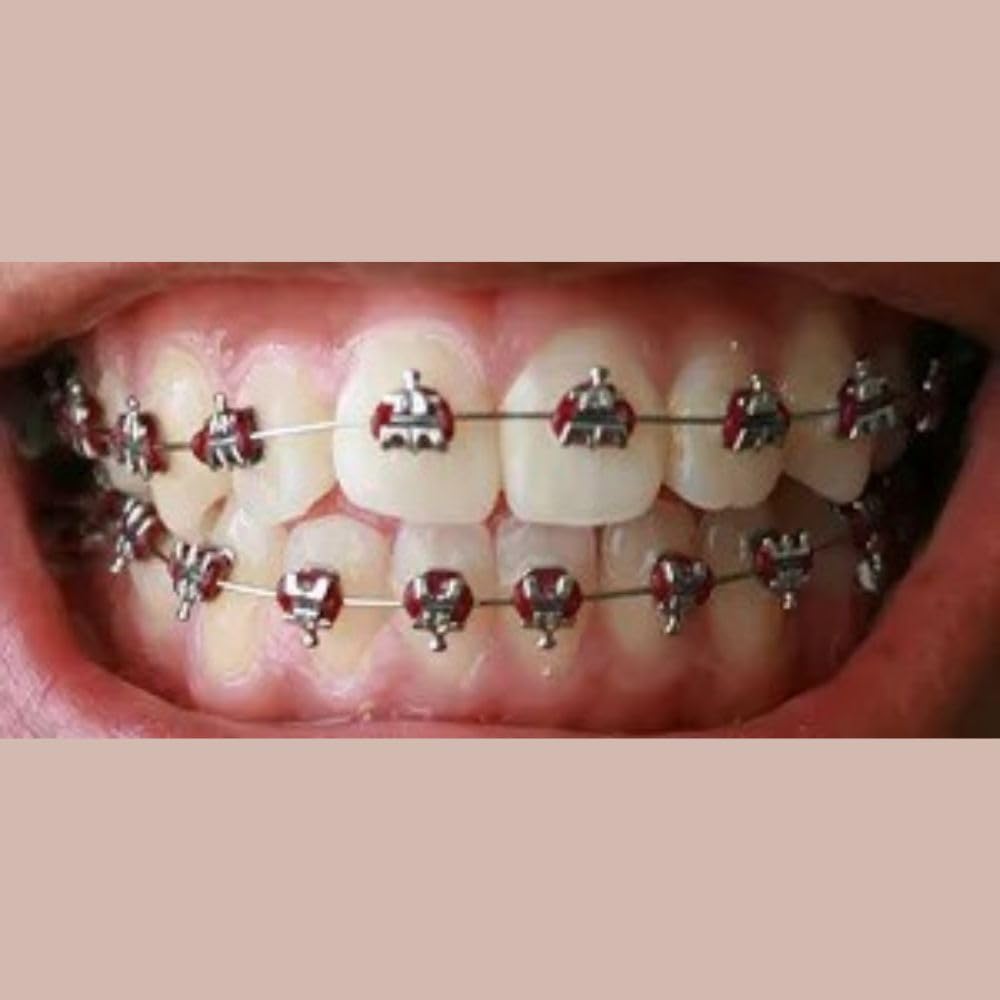 Dental Orthodontic Niti Arch Wire Super Elastic Rectangular Ovoid