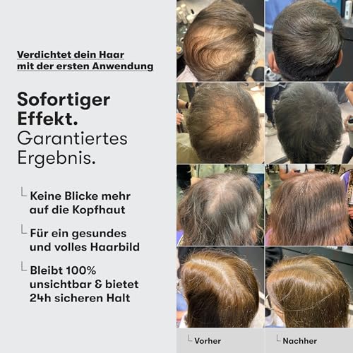 O.C. HAIRCARE Streuhaar zur Haarverdichtung - für Scheitel, kahle Stellen am Ober- und Hinterkopf - von führenden Salons empfohlen - 11 Farben - widerstandsfähige Streuhaare (Mittelbraun)