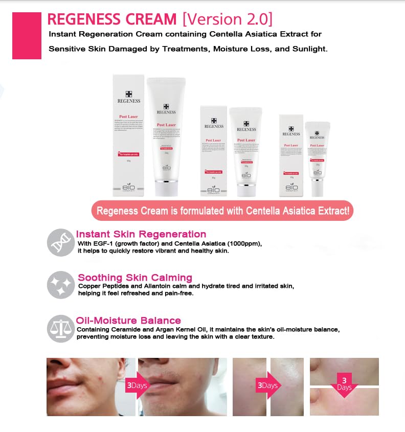 Amazon.co.jp: Regenes Cream Post Laser Care Cream Facial Care
