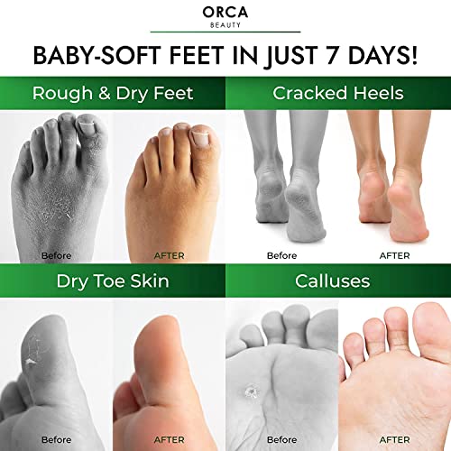Foot-Peel-Mask-for-Dry-Cracked-Feet-8-Pairs-Foot-Mask-Peel-Foot-Callus-Remover-Dead-Skin-Remover-for-Feet-Peeling-Mask-Callous-Removers-for-Feet-Masks-Peeling-Foot-Masks-Peach-Tea-Tree-Scent