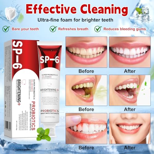 Sp-6 Probiotic Brightening Toothpaste, 2PCS 140g Super Probiotic SP-6 Whitening Tooth Paste for Oral Health, Fresh Breath, Deep Cleaning Oral Care Toothpaste - Image 4