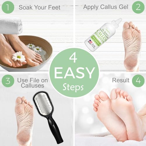 Dr. Entre\'s Callus Remover Gel & Foot File: Extra Strength Callus Remover for Feet, Foot Callus Remover Care, Pedicure Tools Supplies, Spa Kit, Dead Skin Scrubber, 4 oz - Thumbnail 6