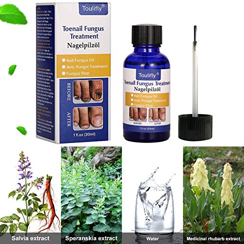Nagelpflege und Behandlung, Nagelpflege für gesunde Fuà und Hand, Nagelpflegeöl,Nagelpflege pflegend – Bild 4