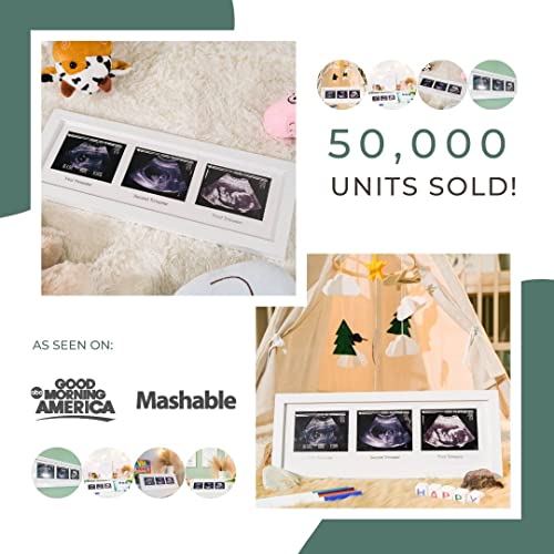 Babysquad Trimester Ultrasound And Sonogram Progression Photo Frame, Extra Large Size, Shatter Resistant Tempered Glass,16.5 X 6.5 Inches, Bonus Matte Insert, Sawtooth Hanger + Kickstand Stand #TOP5