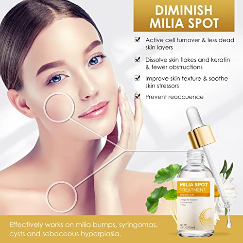 buying guides for best skin tag removal MiliaRemover MiliaTreatment