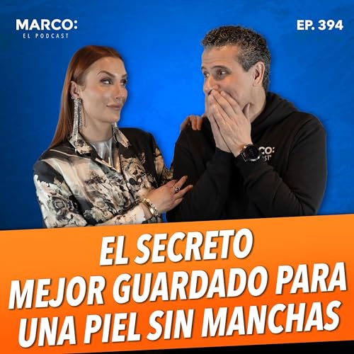 『394.- Cómo quitar manchas sin dañar tu piel
- Karen Carrillo』のカバーアート