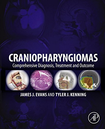 Craniopharyngiomas: Comprehensive Diagnosis, Treatment and Outcome