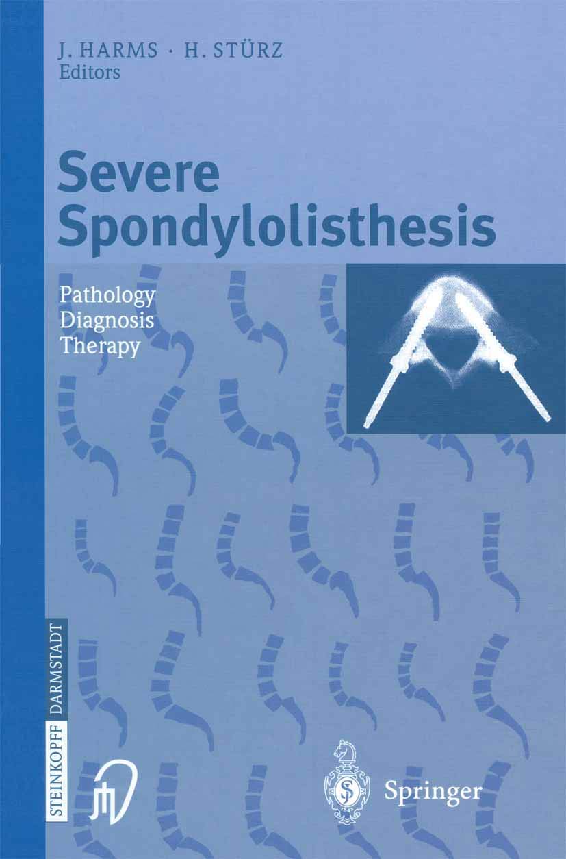 Buy Severe Spondylolisthesis: Pathology - Diagnosis - Therapy — BookShops.in