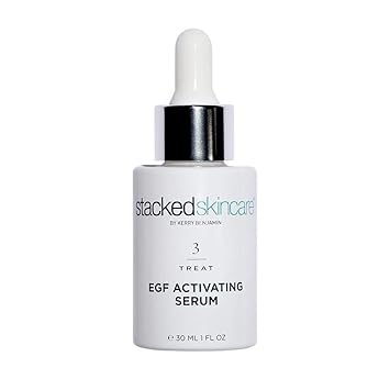 hyperpigmentation treatment cream