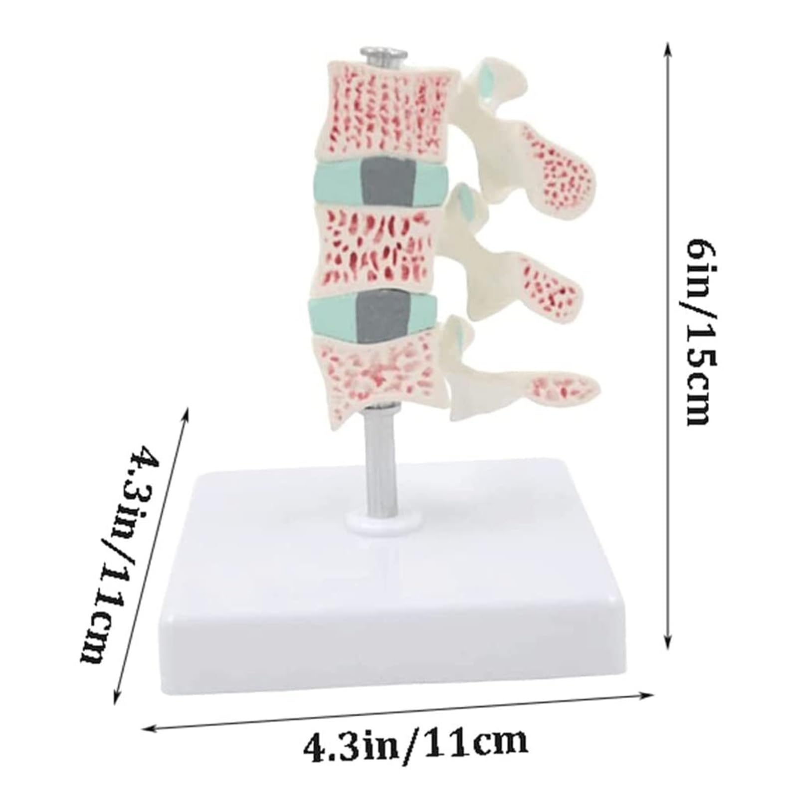 Modelo de Columna Vertebral Humana, Modelo de osteoporosis, Modelo anatómico con órganos de Columna Vertebral Humana extraíbles, Modelo anatómico for Oficina y Estudio de Estudiantes