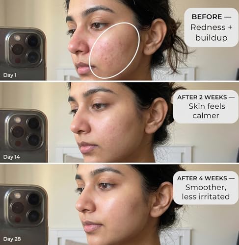 Image of VEDICDERM Red Vine Deep Facial Cleanser - pH-Balanced Face Wash with Ceramides & Peptides | For Acne, Rosacea, Eczema, Aging & Sensitive Skin | Sulfate-Free, Paraben-Free | 100ml (Pack of 1)