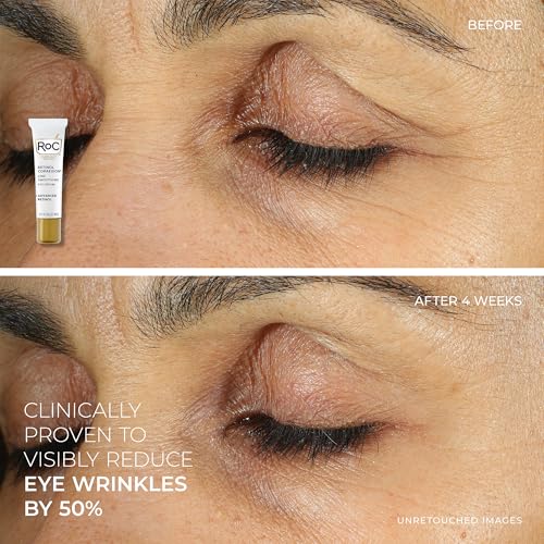 RoC Retinol Correxion Line Smoothing Eye Cream + Retinol Serum Capsules For Night + Max Hydration Crème With Hyaluronic Acid For Day, Skin Care Routine for Women and Men - image 5