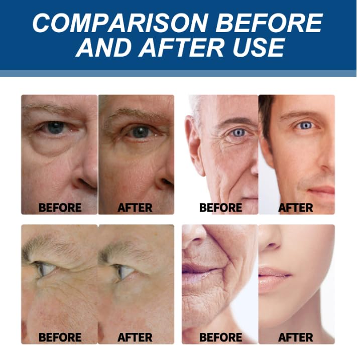 6-in-1 Face Cream for Men, Anti-Aging Moisturizer with Collagen, Hyaluronic Acid and Shea Butter, Reduces Wrinkles, Dark Circles and Puffiness, Men's Formula Daily Care 1.76 fl oz (1) - Image 6