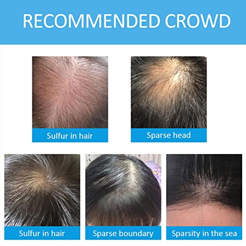 Fibras para melhorar o cabelo - Fibras capilares para queda de cabelo,Indetectável e natural com fib