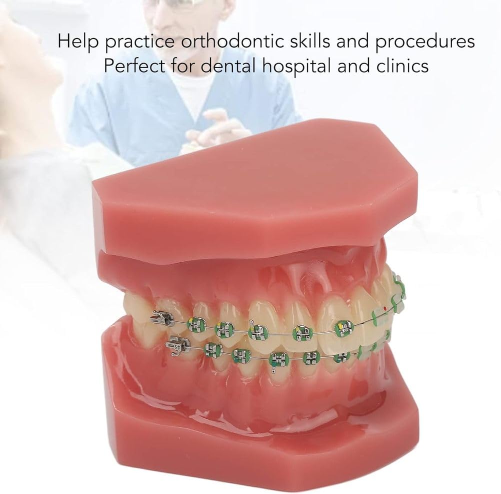 Modello di Ortodonzia Dentale,Modello di Ortodonzia Dentale in Resina,Modello di Ortodonzia Dentale Modello Dentale con Supporto di Fili Metallici per L'insegnamento