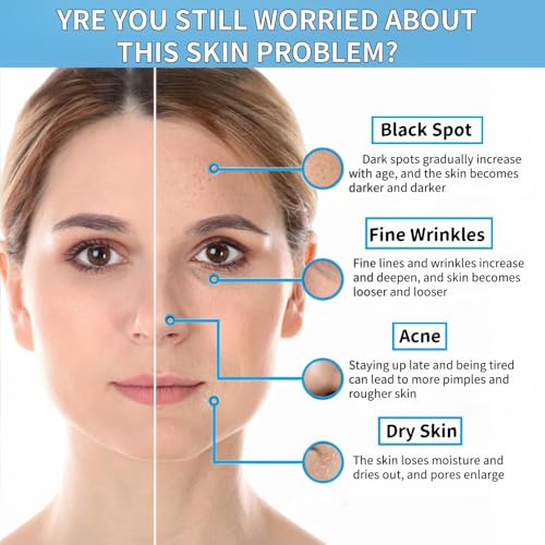 Niacinamide 10% + Zinc 1% Serum for Face – Oil Control, Acne, Pore Minimizer & Blemish Reduction – Lightweight, Non-Greasy Facial Serum, 30ml (1 Fl Oz) (1) - Image 5