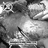  necrotizing fasciitis