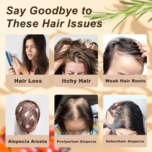 Image of Batana Rosemary Shampoo for Thinning Hair, Biotin Strengthening Shampoo for Men & Women,Nourishing Scalp Care for Fuller Looking,Healthier Hair,Sulfate Free Daily Hair Cleanser 10.15 fl oz