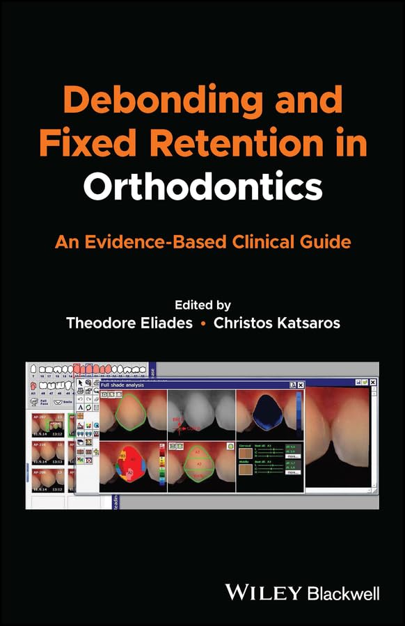 Debonding and Fixed Retention in Orthodontics An EvidenceBased