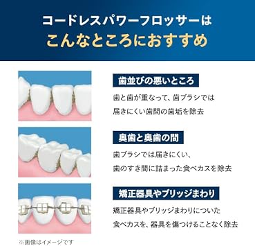 Philips Jet Washer Sonicare Cordless Power Flosser 3000 Oral Irrigator X-shaped Water Jet Washer HX3826/23 Black Exclusive